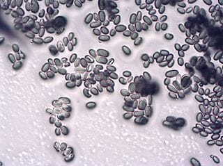 Magnified mold spores, which inside a home can cause illness and allergies